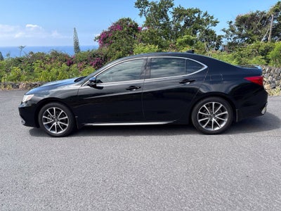 2018 Acura TLX 3.5L V6 w/Technology Package